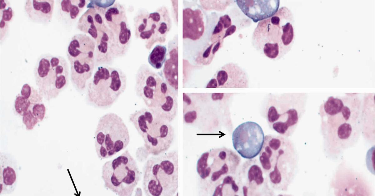 The fascinating Naegleria, scientifically known as Naegleria fowleri.